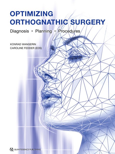 Optimizing Orthognathic Surgery, Konrad Wangerin