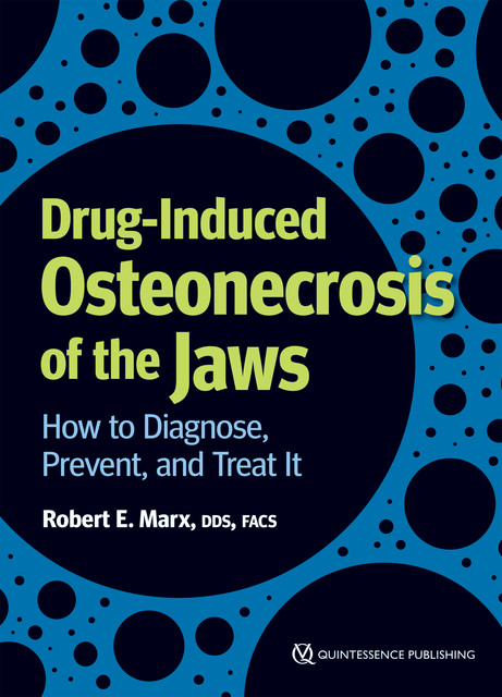 Drug-Induced Osteonecrosis of the Jaws, Robert E. Marx