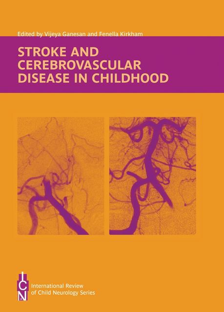 Stroke and Cerebrovascular Disease in Children, Fenella Kirkham, Vijeya Ganesan