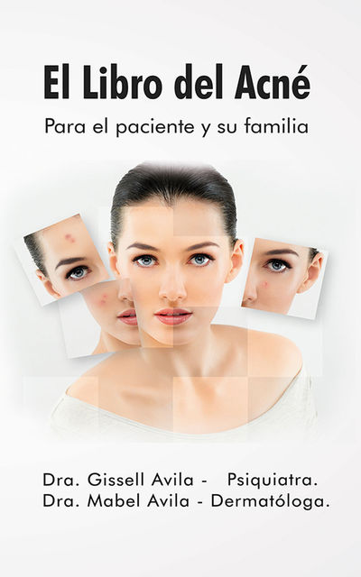El libro del acné, Dra. Gissell Ávila, Dra. Mabel Ávila