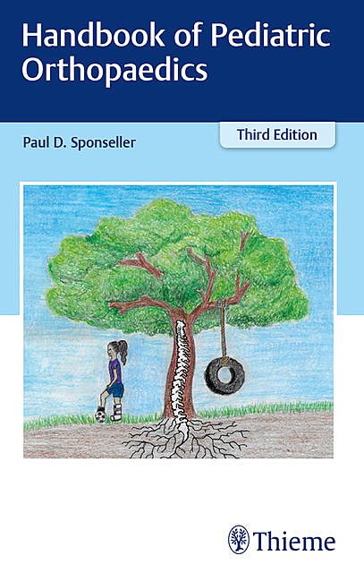 Handbook of Pediatric Orthopaedics, Paul D.Sponseller