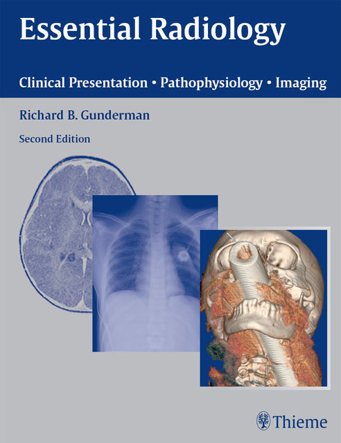Essential Radiology, Richard B.Gunderman