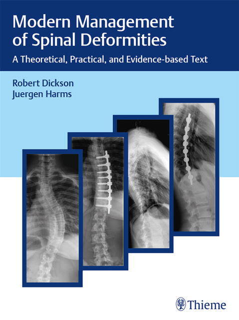 Modern Management of Spinal Deformities, Robert A.Dickson, Juergen Harms