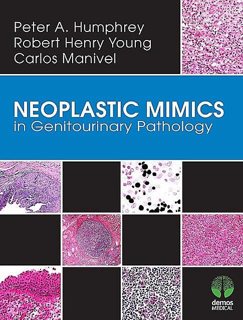 Neoplastic Mimics in Genitourinary Pathology, Robert Young, J. Carlos Manivel, Peter A. Humphrey