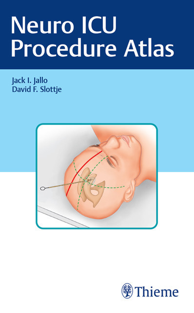 Neuro ICU Procedure Atlas, Jack Jallo, David F. Slottje
