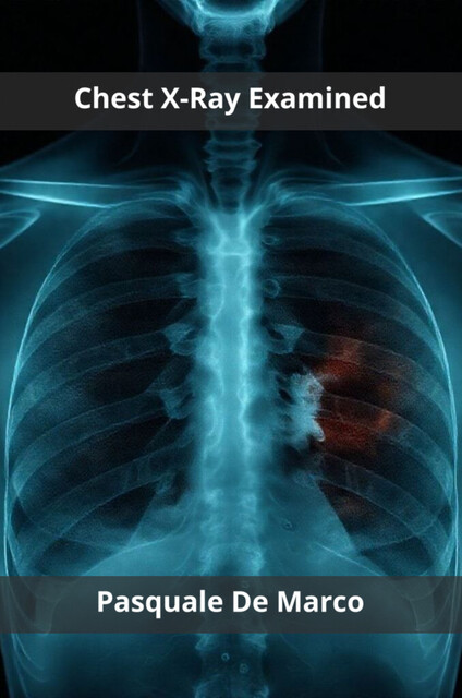 Chest X-Ray Examined, Pasquale De Marco