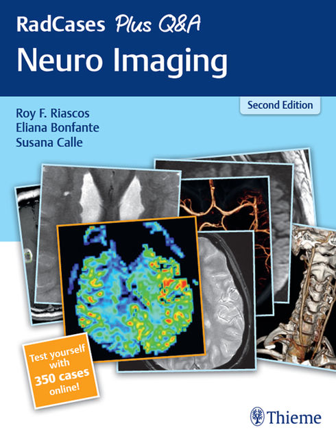 RadCases Plus Q&A Neuro Imaging, Eliana Bonfante, Roy Riascos, Susana Calle