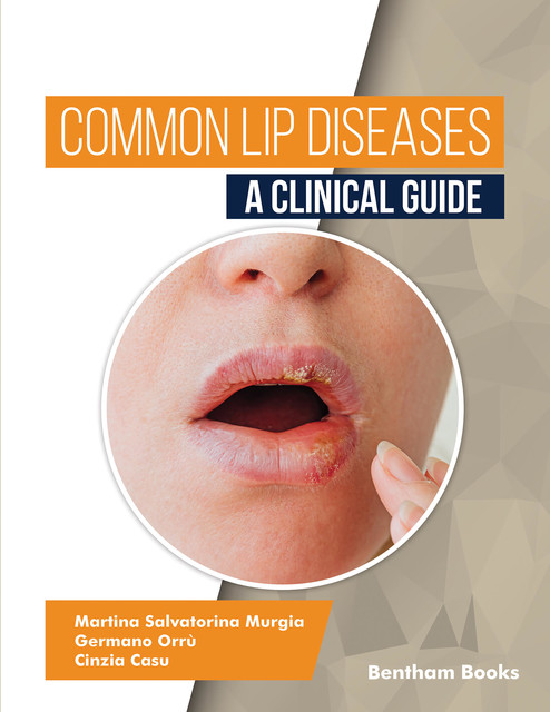 Common Lip Diseases: A Clinical Guide, Cinzia Casu, Germano Orrù, Martina Salvatorina Murgia