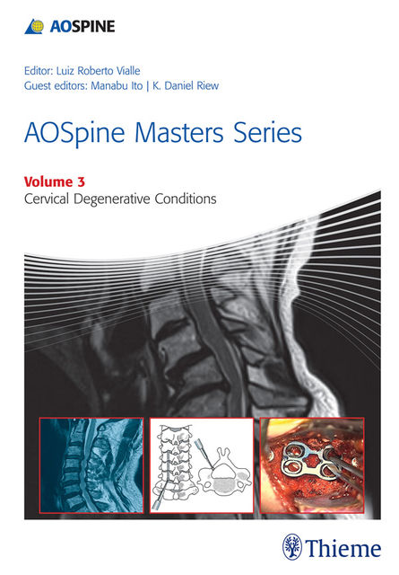 AOSpine Masters Series Volume 3: Cervical Degenerative Conditions, Luiz Roberto Vialle