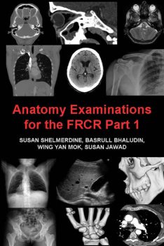 Anatomy Examinations for the FRCR Part 1, Susan Shelmerdine