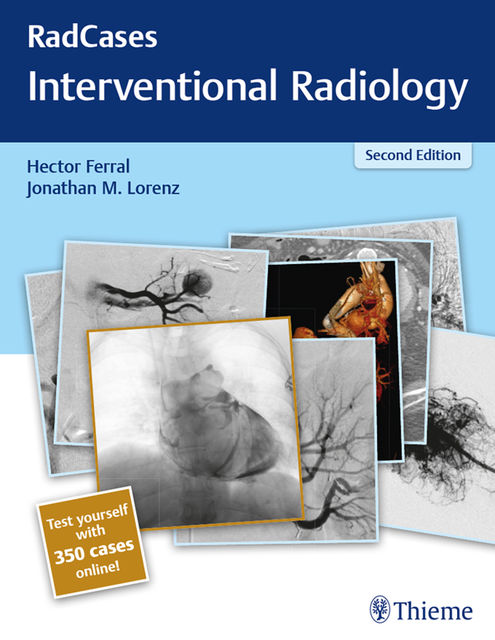Radcases Interventional Radiology, Hector Ferral, Jonathan Lorenz