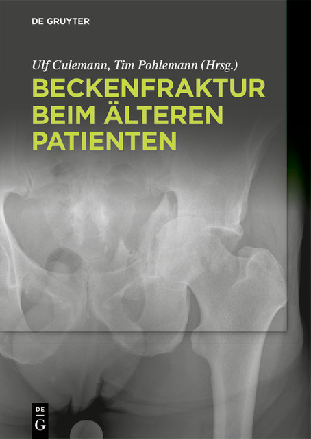 Beckenfraktur beim älteren Patienten, Tim Pohlemann, Ulf Culemann