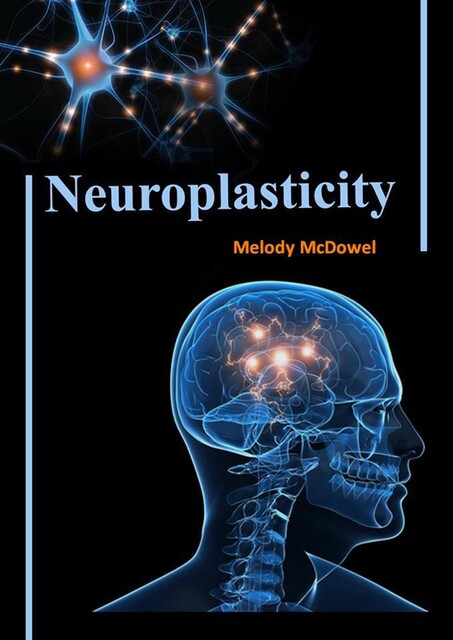 Neuroplasticity, Melody MyDowel