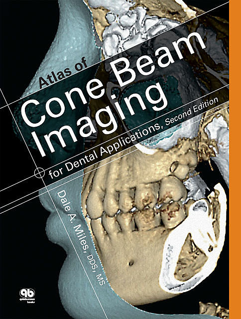 Atlas of Cone Beam Imaging for Dental Applications, Dale A. Miles