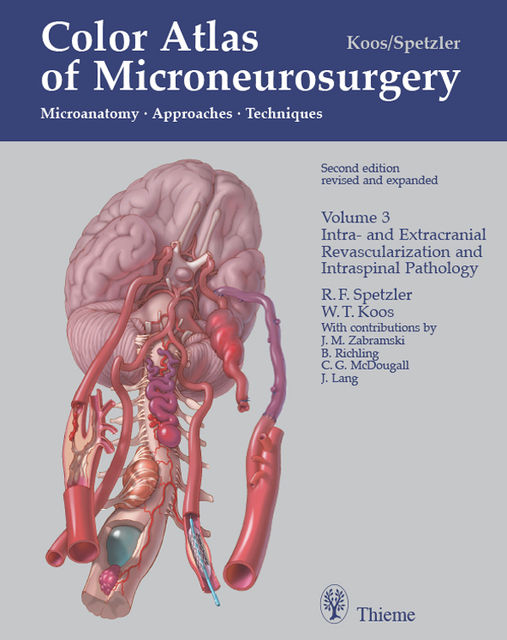 Color Atlas of Microneurosurgery, Volume 3: Intra- und Extracranial Revascularization and Intraspinal Pathology, Robert F.Spetzler, W.Koos, Johannes Lang