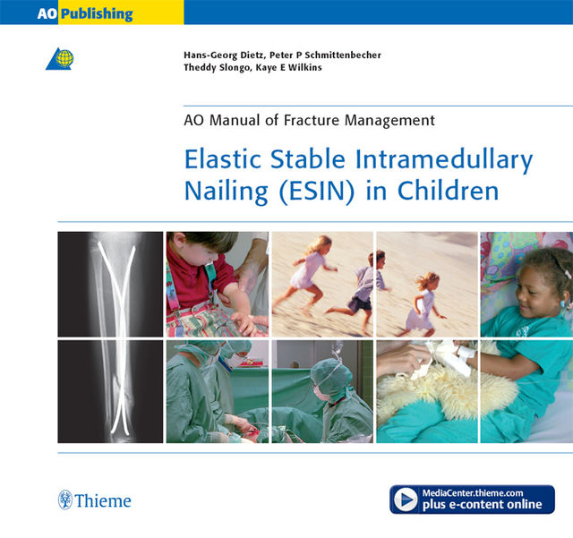 Elastic Stable Intramedullary Nailing (ESIN) in Children, Hans-Georg Dietz, Peter P Schmittenbecher, Theddy Slongo