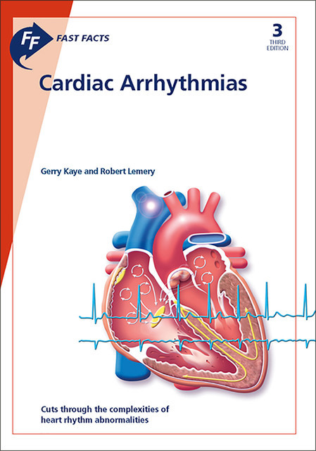 Fast Facts: Cardiac Arrhythmias, Kaye, R. Lemery