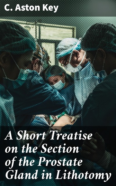A Short Treatise on the Section of the Prostate Gland in Lithotomy, C. Aston Key
