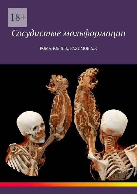 Сосудистые мальформации, Дмитрий Романов, Амриддин Рахимов