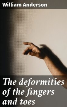 The deformities of the fingers and toes, William Anderson