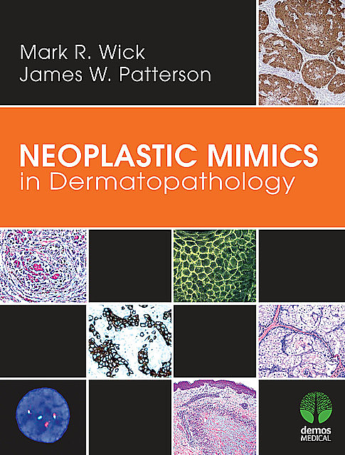 Neoplastic Mimics in Dermatopathology, James Patterson, Mark R. Wick