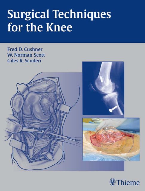Surgical Techniques for the Knee, Fred D.Cushner, Giles R.Scuderi, W.Norman Scott