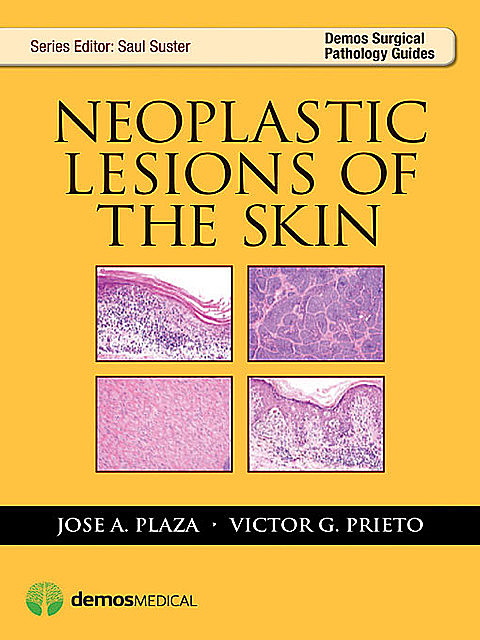 Neoplastic Lesions of the Skin, Jose A. Plaza, Victor G. Prieto