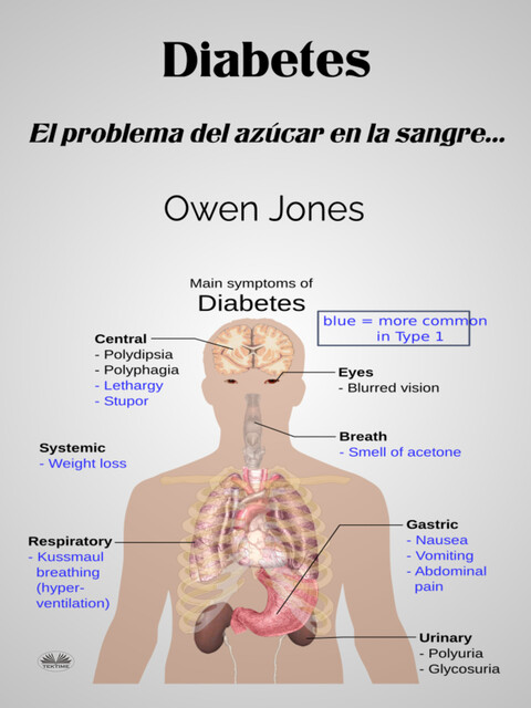 Diabetes-El Problema Del Azúcar En La Sangre, Owen Jones
