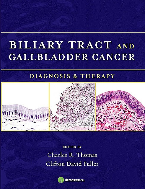 Biliary Tract and Gallbladder Cancer, Thomas Charles, Clifton D. Fuller