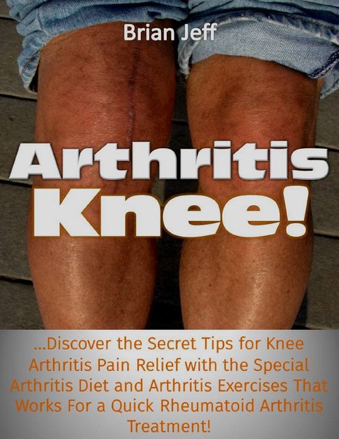 Arthritis Knee!: Discover the Secret Tips for Knee Arthritis Pain Relief With the Special Arthritis Diet and Arthritis Exercises That Works for a Quick Rheumatoid Arthritis Treatment!, Brian Jeff