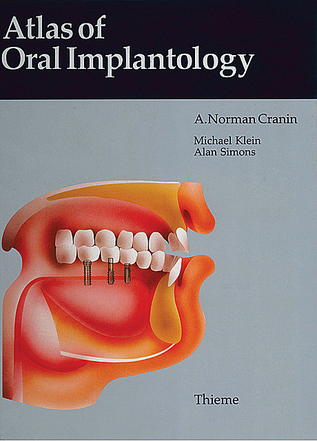 Atlas of Oral Implantology, Michael Klein, A. Norman Cranin, Alan Simons