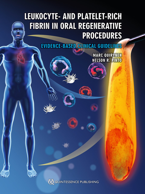 Leukocyte- and Platelet-Rich Fibrin in Oral Regenerative Procedures, Marc Quirynen, Nelson R. Pinto
