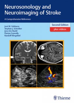 Neurosonology and Neuroimaging of Stroke, Jens-Eric Rohl, Jose Manuel Valdueza, Stephan Schreiber