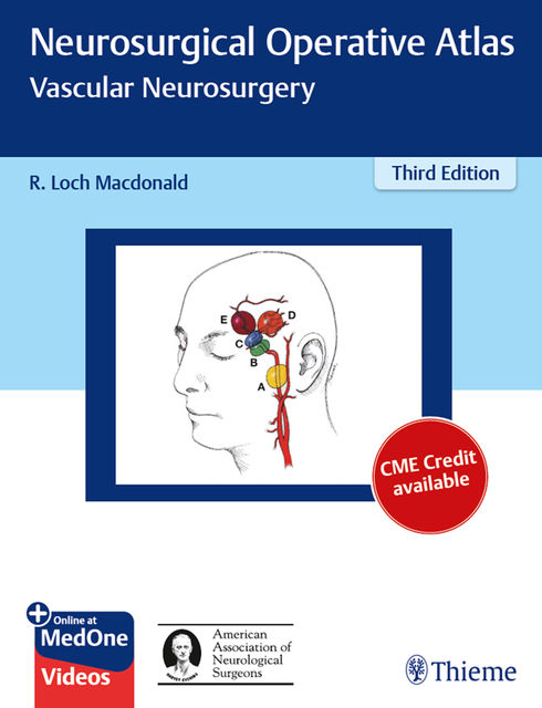 Neurosurgical Operative Atlas: Vascular Neurosurgery, R.Loch Macdonald