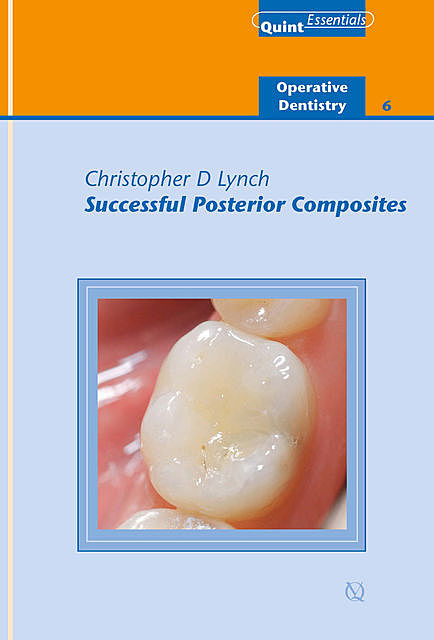 Successful Posterior Composites, Christopher Lynch