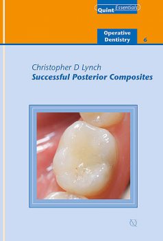 Successful Posterior Composites, Christopher Lynch