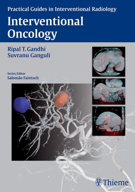 Interventional Oncology, Ripal T. Gandhi, Suvranu Ganguli