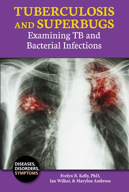 Tuberculosis and Superbugs, Marylou Ambrose, Evelyn B.Kelly, Ian Wilker