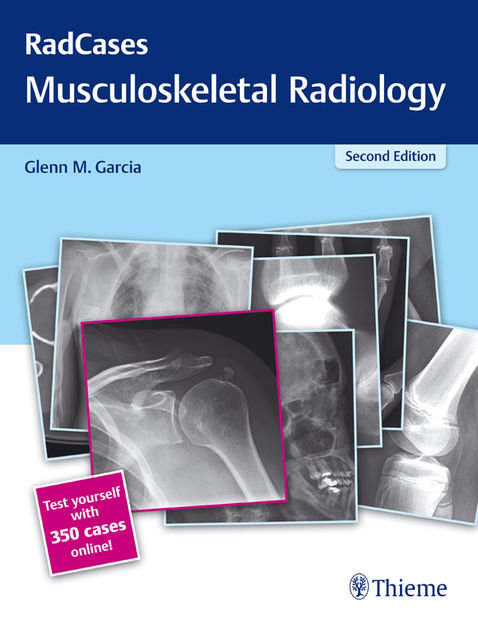 Radcases Musculoskeletal Radiology, Glenn M.Garcia, Hector Ferral, Jonathan Lorenz
