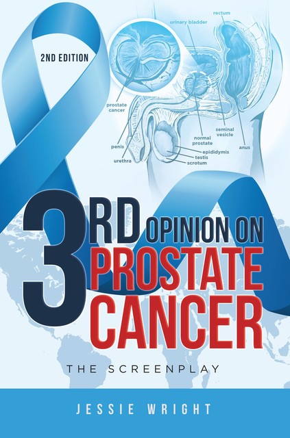 3rd Opinion on Prostate Cancer, Jessie Wright