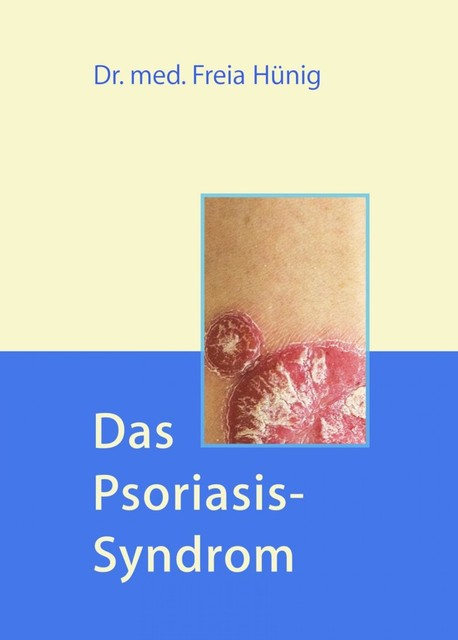 Das Psoriasis-Syndrom, Freia Hünig
