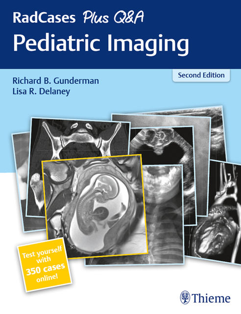 RadCases Plus Q&A Pediatric Imaging, Lisa R.Delaney, Richard B.Gunderman