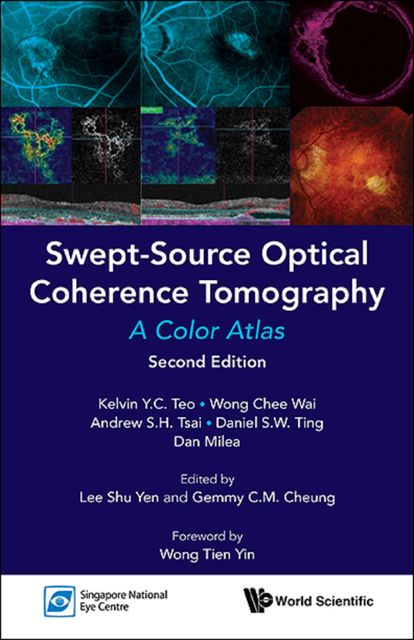Swept-Source Optical Coherence Tomography, AndrewS.H.Tsai, Chee Wai Wong, DanielS.W.Ting, KelvinY.C.Teo, Tien Yin Wong, Dan Milea, GemmyC.M. Cheung, Shu Yen Lee