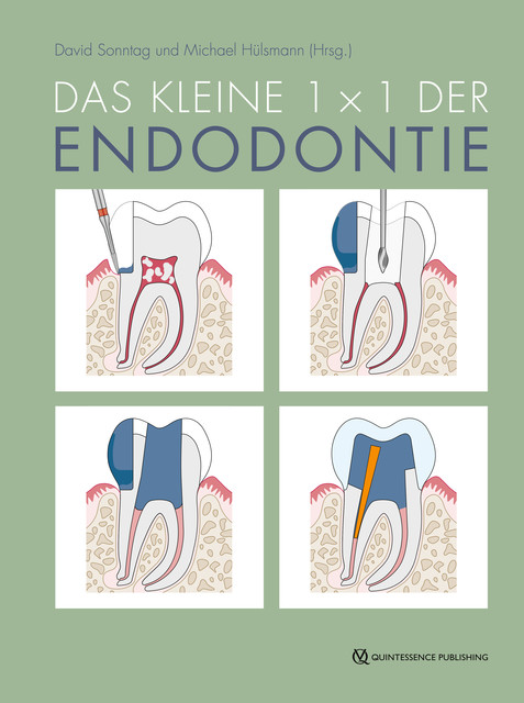 Das kleine 1x1 der Endodontie, Michael Hülsmann, David Sonntag