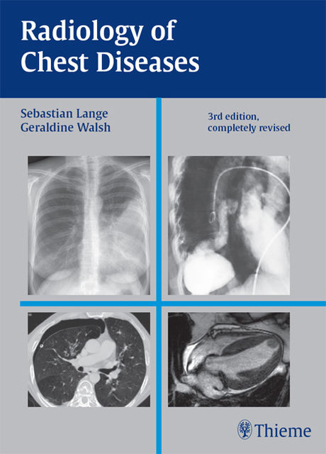 Radiology of Chest Diseases, Geraldine Walsh, Sebastian Lange