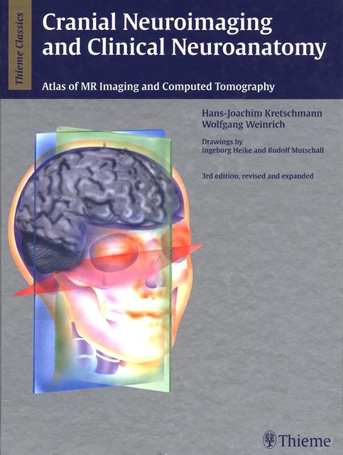 Cranial Neuroimaging and Clinical Neuroanatomy, Hans-Joachim Kretschmann, Wolfgang Weinrich