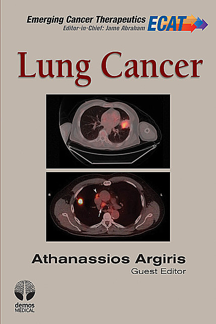 Lung Cancer, Thomas Charles