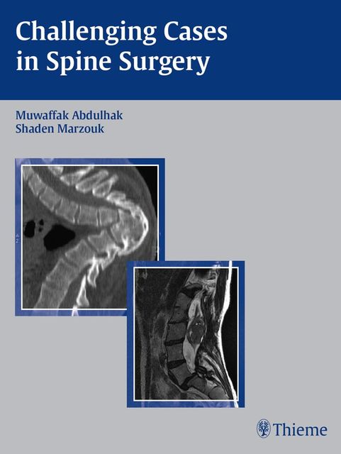 Challenging Cases in Spine Surgery, Muwaffak Abdulhak, Shaden Marzouk