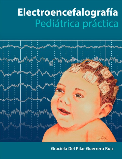 Electroencefalografía Pediatría Práctica, Graciela Del Pilar Guerrero Ruiz