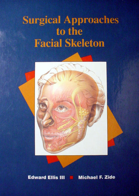 Surgical Approaches to the Facial Skeleton, E.Ellis, F.Z.Michael